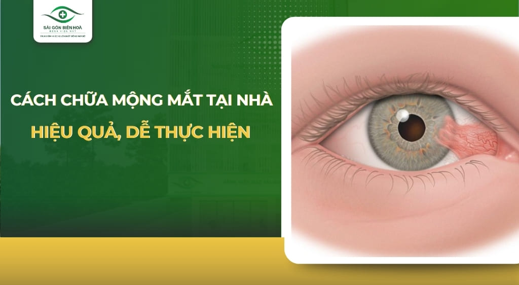 cách chữa mộng thịt tại nhà