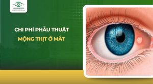 chi phí phẫu thuật mộng thịt ở mắt