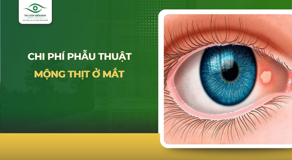 chi phí phẫu thuật mộng thịt ở mắt
