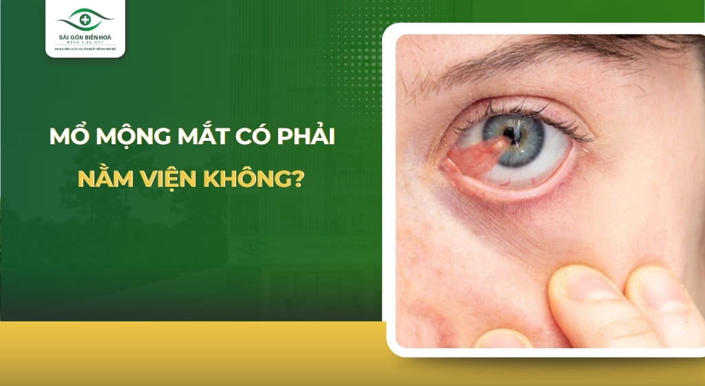 mổ mộng mắt có phải nằm viện không
