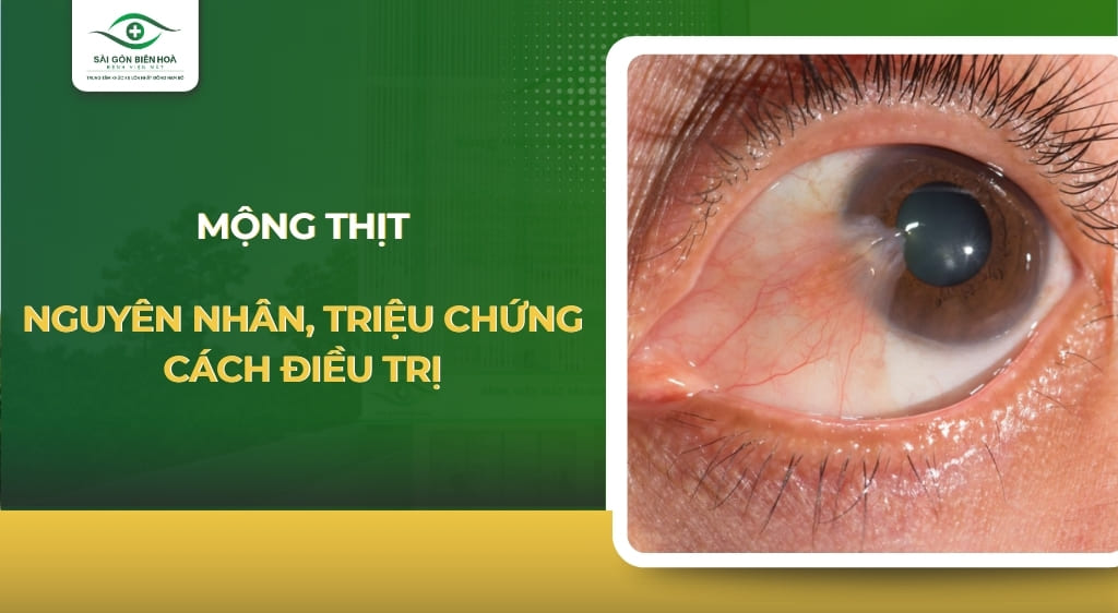 mộng thịt