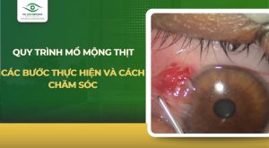 Quy trình mổ mộng thịt