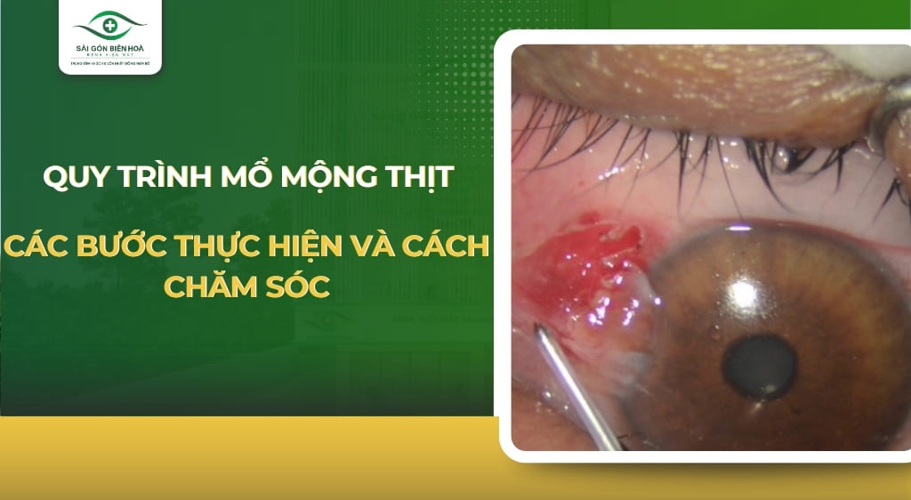 Quy trình mổ mộng thịt