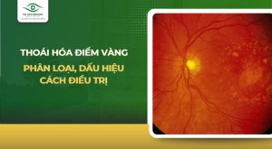 thoái hóa điểm vàng