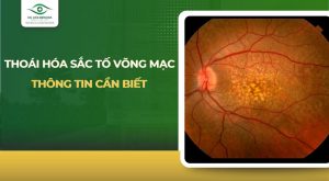 thoái hóa sắc tố võng mạc