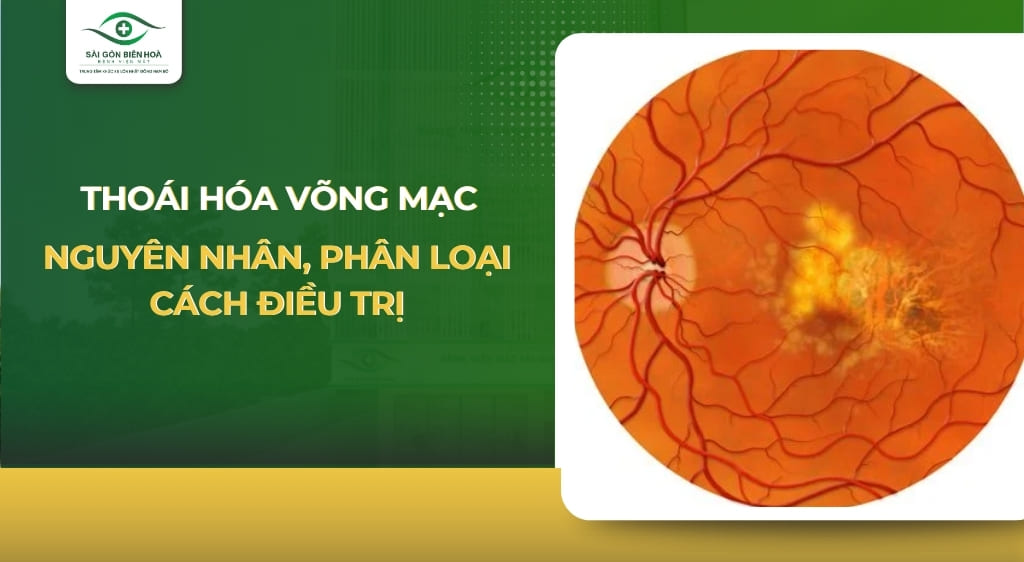 thoái hóa võng mạc