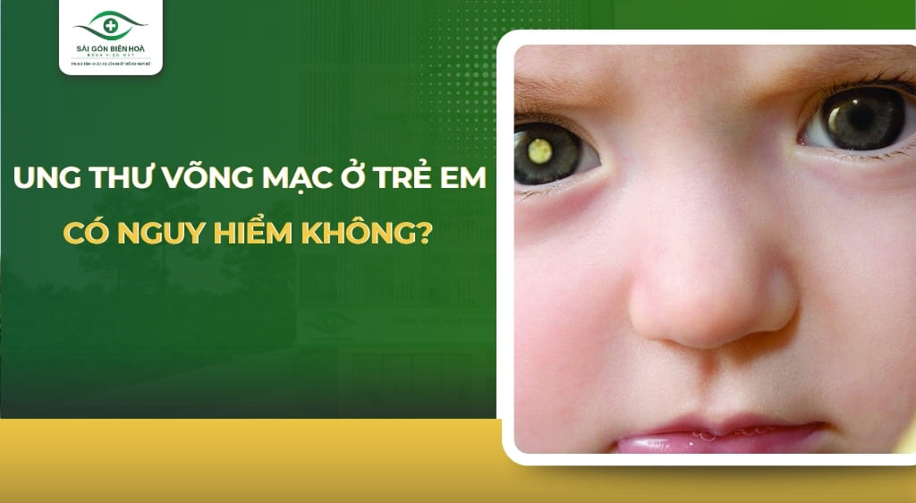 ung thư võng mạc ở trẻ em