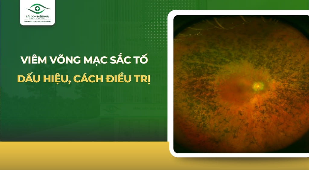 viêm võng mạc sắc tố