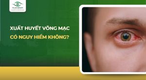 xuất huyết võng mạc có nguy hiểm không