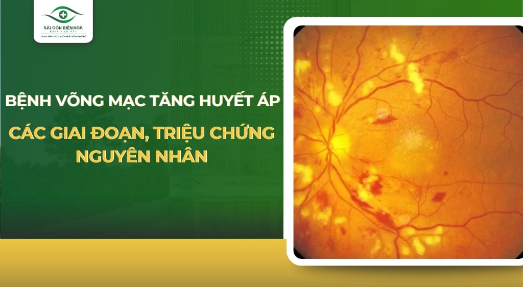 bệnh võng mạc tăng huyết áp