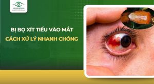bị bọ xít tiểu vào mắt