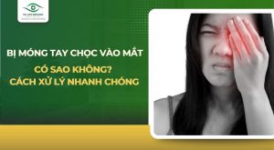 bị móng tay chọc vào mắt