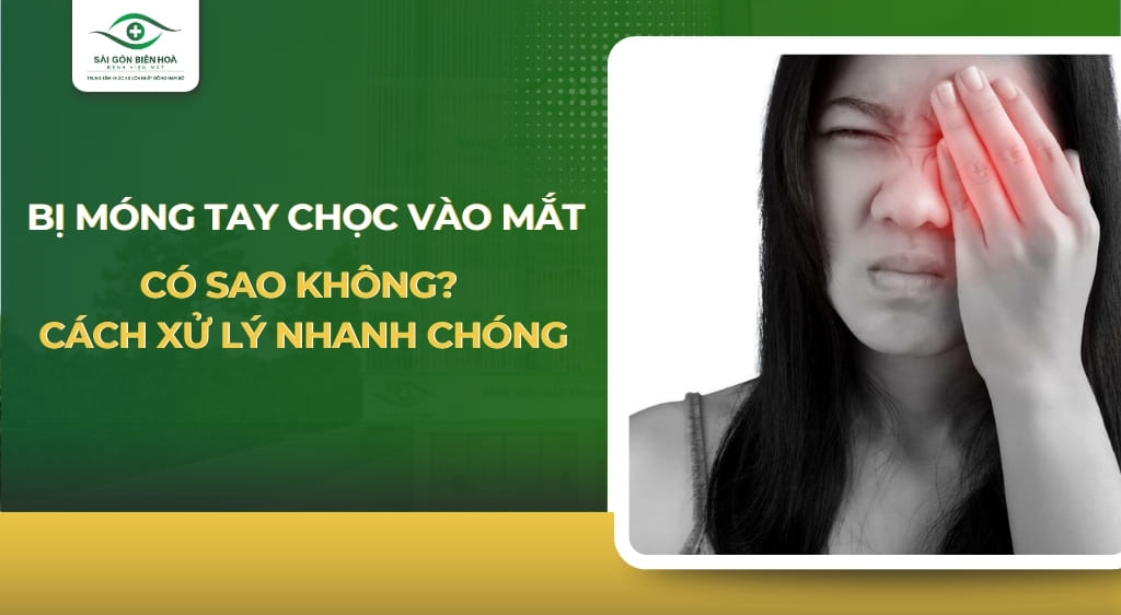 bị móng tay chọc vào mắt