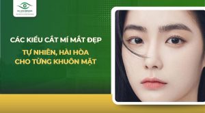 các kiểu cắt mí