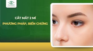 cắt mắt 2 mí
