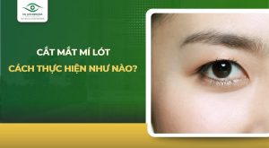 cắt mắt mí lót