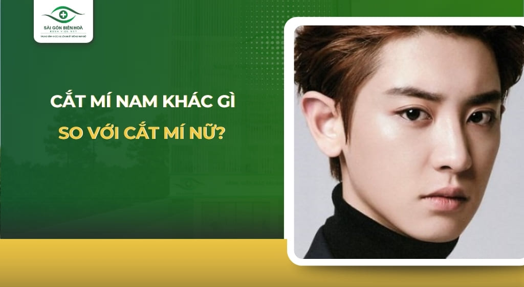 cắt mí nam