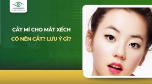 cắt mí cho mắt xếch
