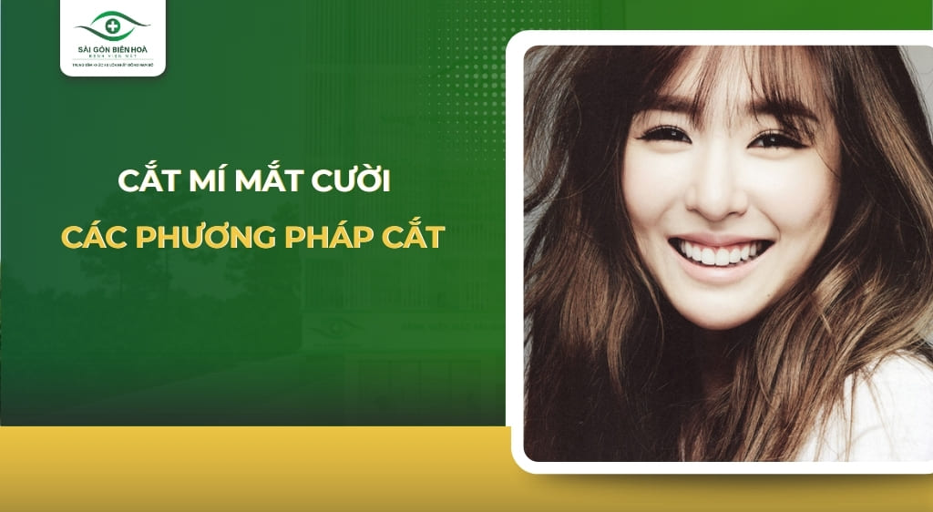 cắt mí mắt cười