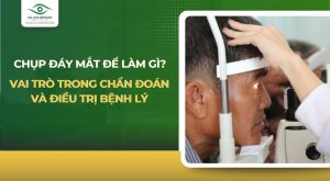 chụp đáy mắt để làm gì