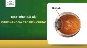 dịch kính là gì