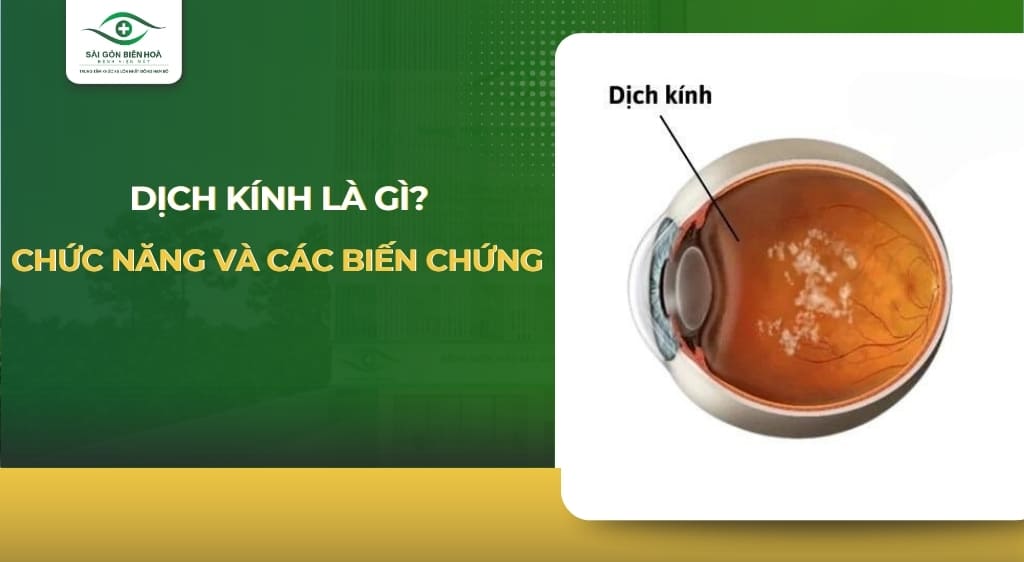 dịch kính là gì