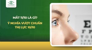 mắt 11/10