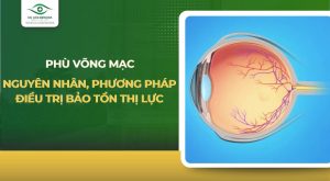 phù võng mạc
