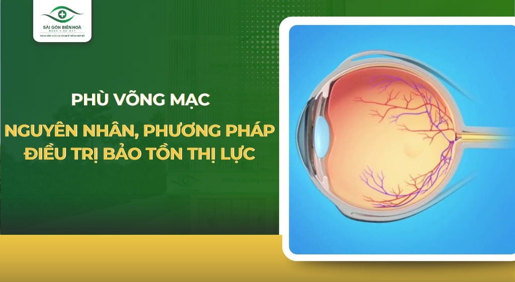 phù võng mạc