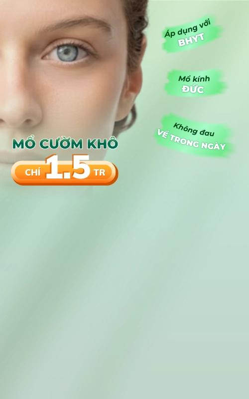 Promotion mổ cườm 1,5tr