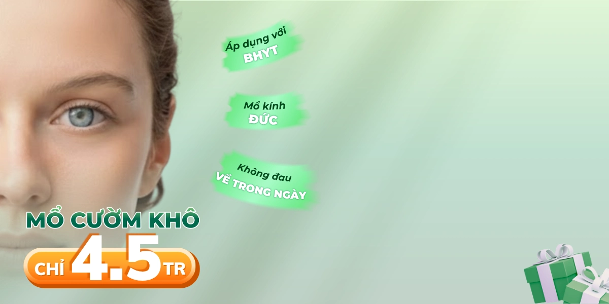 Promotion mổ cườm 4.5 triệu