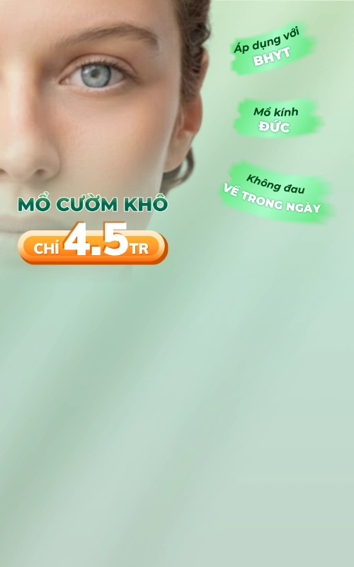 Promotion mổ cườm 4.5 triệu