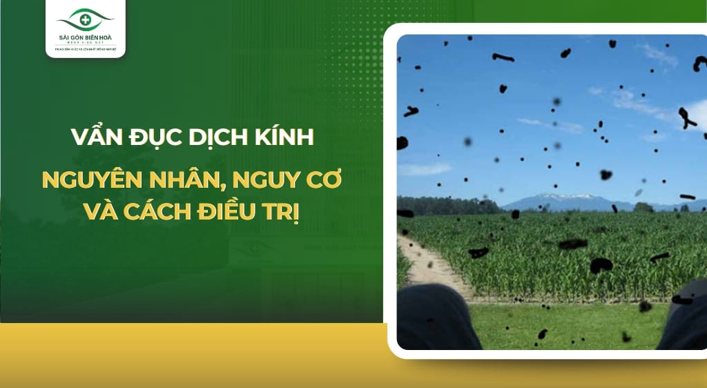 vẩn đục dịch kính