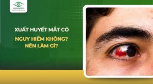xuất huyết mắt có nguy hiểm không