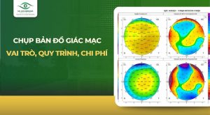 bản đồ giác mạc