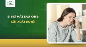 bị mờ mắt sau khi bị sốt xuất huyết