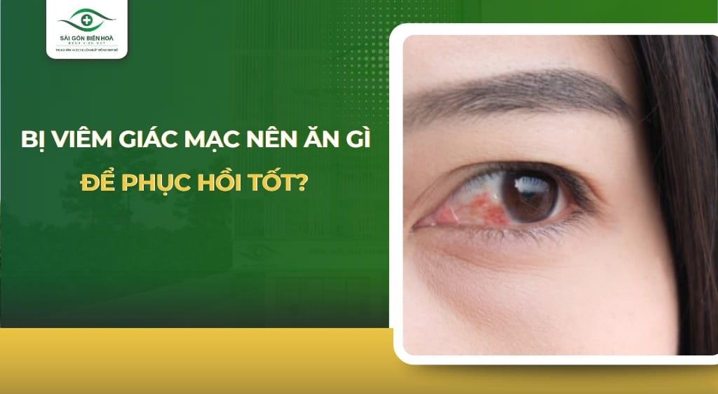 bị viêm giác mạc nên ăn gì