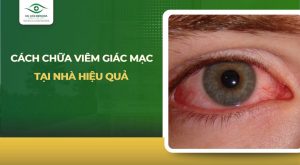 cách chữa viêm giác mạc