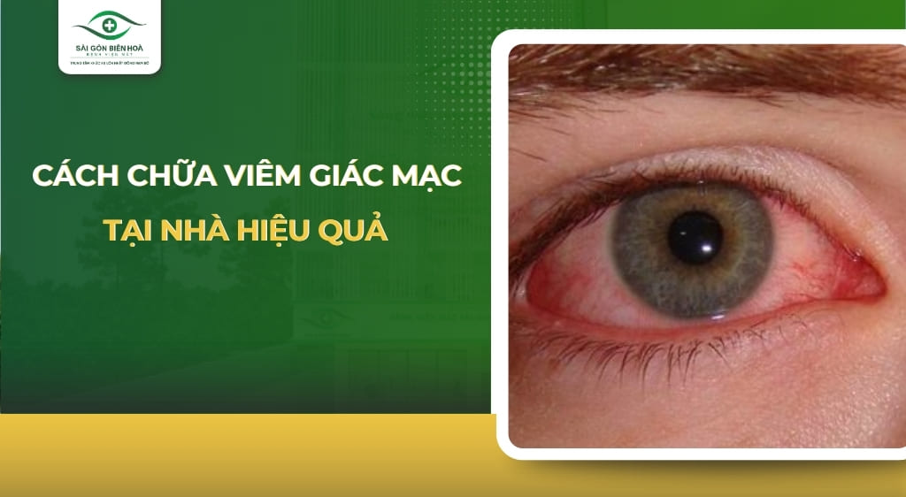 cách chữa viêm giác mạc