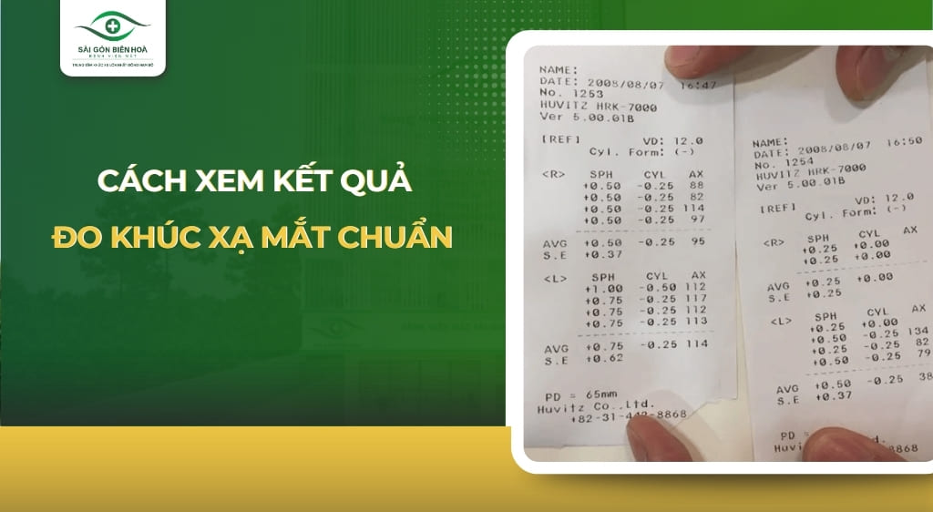 cách xem kết quả đo khúc xạ mắt