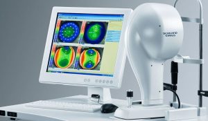 Hệ thống Schwind Sirius – Tiêu chuẩn vàng trong chẩn đoán trước phẫu thuật