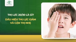 mắt 20 30 là gì