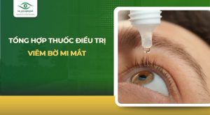 thuốc điều trị viêm bờ mi mắt
