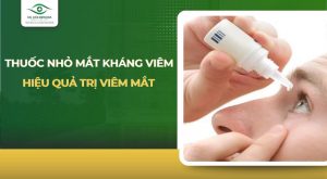 thuốc nhỏ mắt kháng viêm