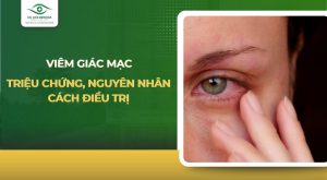 viêm giác mạc