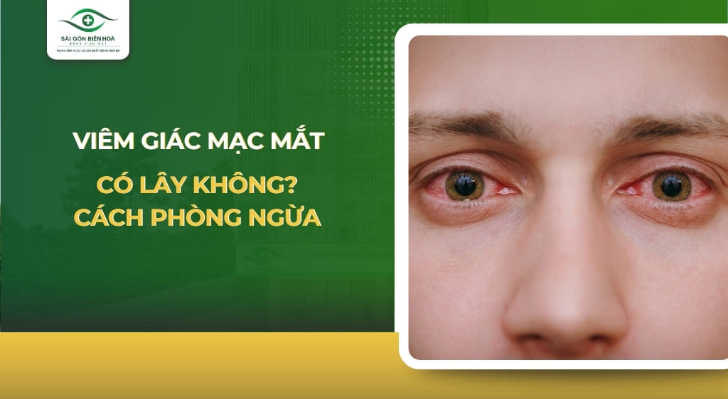 viêm giác mạc mắt có lây không