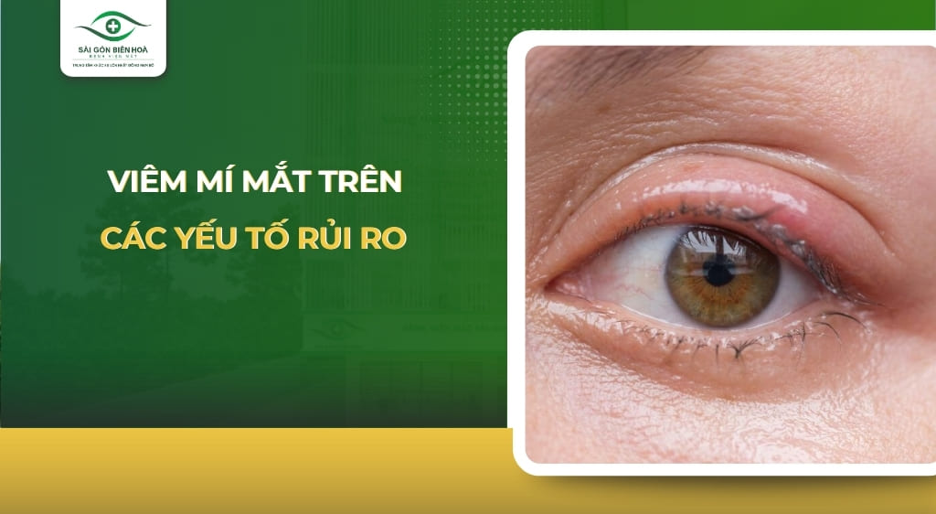 viêm mí mắt trên