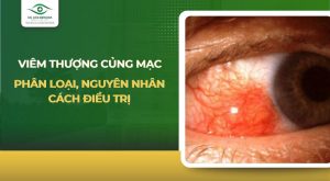 viêm thượng củng mạc