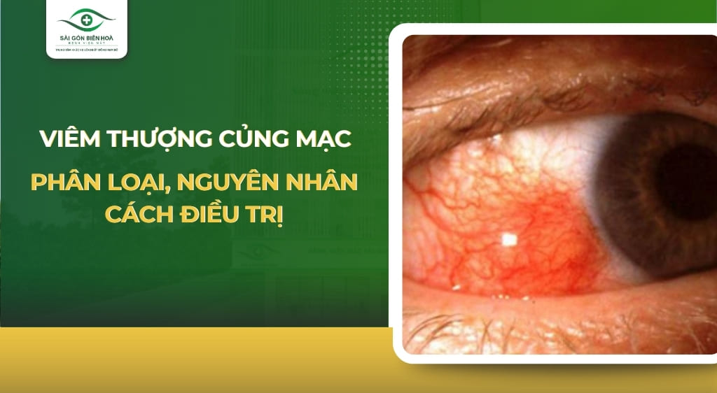 viêm thượng củng mạc