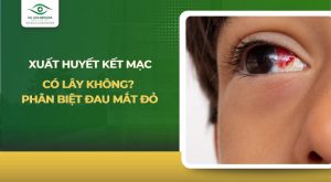 xuất huyết kết mạc có lây không